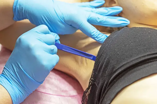 stock image cosmetologist shaves off excess hair with a razor before laser hair removal underarms in a beauty salon Self-care and self-care