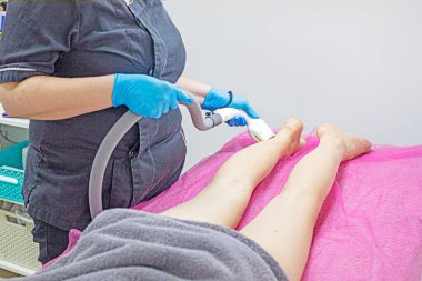 Kozmetik uzmanı bacağındaki fazla kılları lazer cihazıyla alıyor. Vücut bakımı ve güzellik