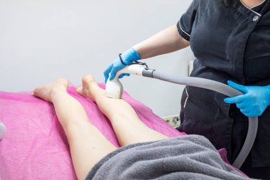 Kozmetik uzmanı bacağındaki fazla kılları lazer cihazıyla alıyor. Vücut bakımı ve güzellik
