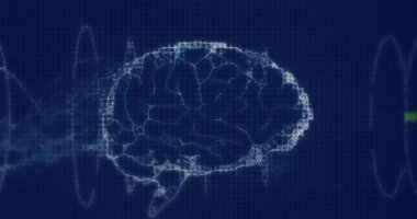 Animation of digital brain on black background. Abstract background, light, pattern and movement concept digitally generated video.