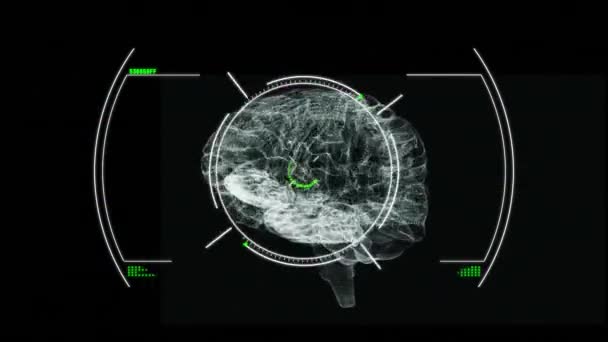 黒の背景にヒトの脳のアイコンを回転させる上でグリッチ効果とスコープスキャンのアニメーション 医学研究技術概念 — ストック動画