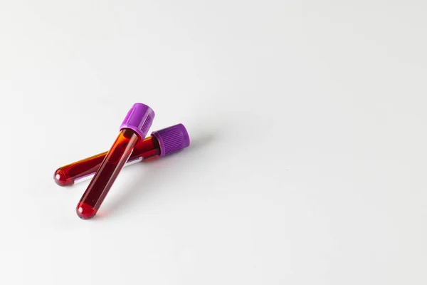 Zwei Blutprobenröhrchen Mit Violetten Deckeln Auf Weißem Hintergrund Mit Kopierraum — Stockfoto