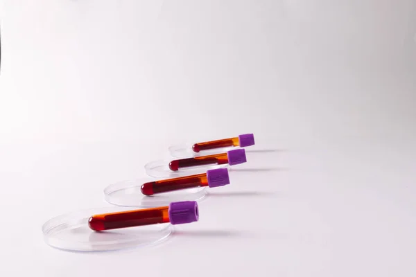 Fila Tubos Amostra Sangue Placas Petri Fundo Branco Com Espaço — Fotografia de Stock