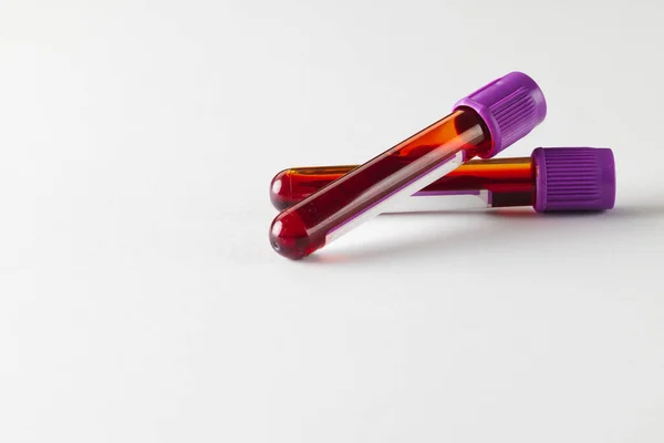 两个有紫色盖子的血样管 白色背景 有复制空间 血液健康诊断 分析和献血 — 图库照片