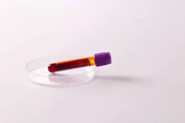 皮氏培养皿中的血样管 白色背景 有复制空间 血液健康诊断 分析和献血 — 图库照片