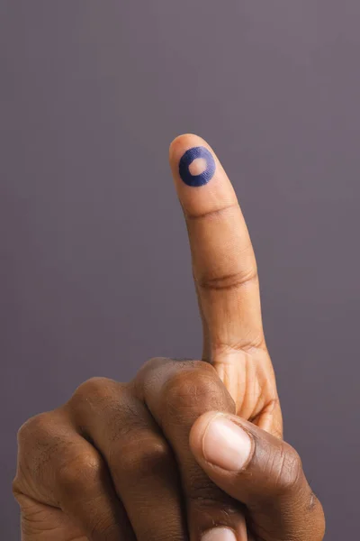 Hand Eines Birassischen Mannes Mit Blauem Ring Ausgestreckten Finger Auf — Stockfoto