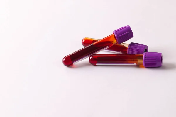 コピースペースの白い背景に紫色の蓋のある3つの血液サンプルチューブ 血液健康診断 — ストック写真