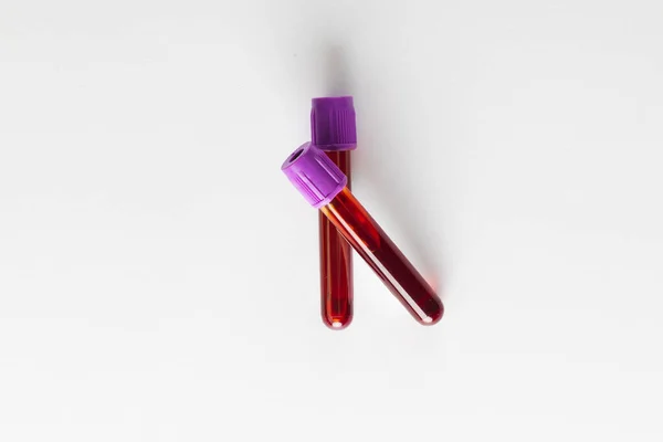 白い背景に紫色の蓋のある2つの血液サンプルチューブ 血液健康診断 — ストック写真