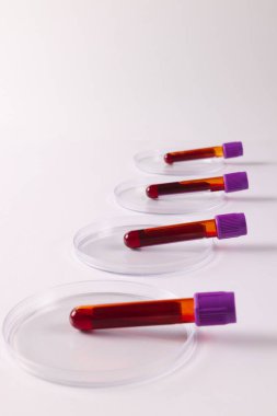 Petri kabında sıra sıra kan örneği tüpleri, beyaz arka planda fotokopi alanı ile. Kan sağlığı teşhisi, analiz ve kan bağışı..