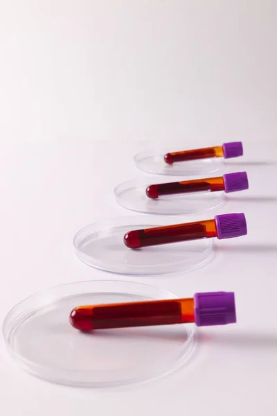 Row Blood Sample Tubes Petri Dishes White Background Copy Space — Stock Photo, Image
