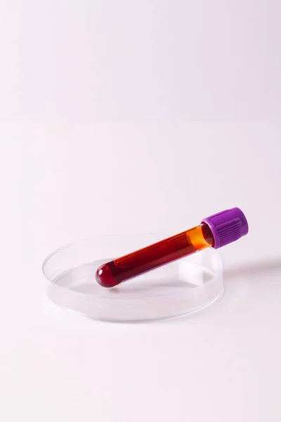 Petri Kabında Kan Örneği Tüpü Beyaz Arka Planda Fotokopi Alanı — Stok fotoğraf