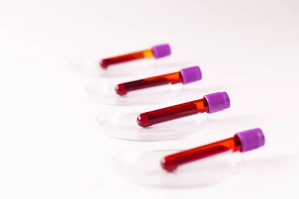 Fila Tubos Amostra Sangue Placas Petri Sobre Fundo Branco Diagnóstico — Fotografia de Stock