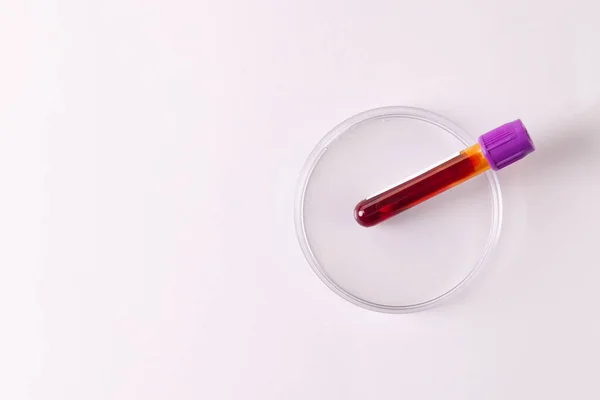 Bloedmonster Buis Petrischaaltje Witte Achtergrond Met Kopieerruimte Bloedgezondheidsdiagnostiek Analyse Donatie — Stockfoto
