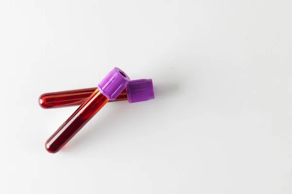 コピースペースの白い背景に紫色の蓋のある2つの血液サンプルチューブ 血液健康診断 — ストック写真