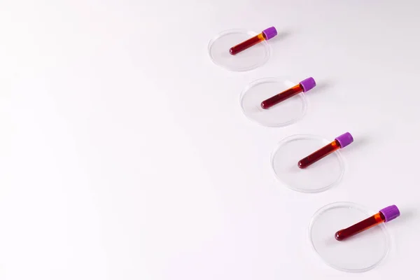 Rij Van Bloedstalen Buizen Petrischaaltjes Witte Achtergrond Met Kopieerruimte Bloedgezondheidsdiagnostiek — Stockfoto