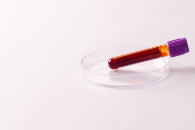 Petri kabında kan örneği tüpü, beyaz arka planda fotokopi alanı var. Kan sağlığı teşhisi, analiz ve kan bağışı..