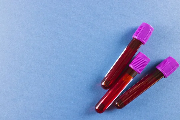 紫色の蓋のある3つの血液サンプルチューブは コピースペースのある青い背景にあります 血液健康診断 — ストック写真