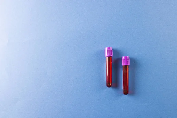 紫色の蓋のある2つの血液サンプルチューブは コピースペースのある青い背景にあります 血液健康診断 — ストック写真