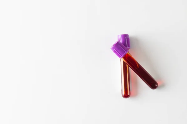 Две Пробы Крови Фиолетовыми Крышками Белом Фоне Копировальным Пространством Диагностика — стоковое фото