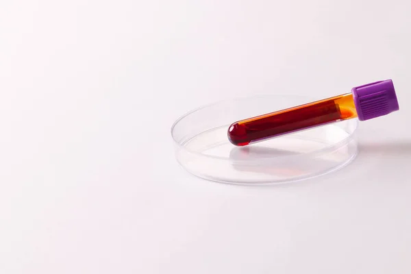 Tubo Amostra Sangue Placa Petri Sobre Fundo Branco Com Espaço — Fotografia de Stock