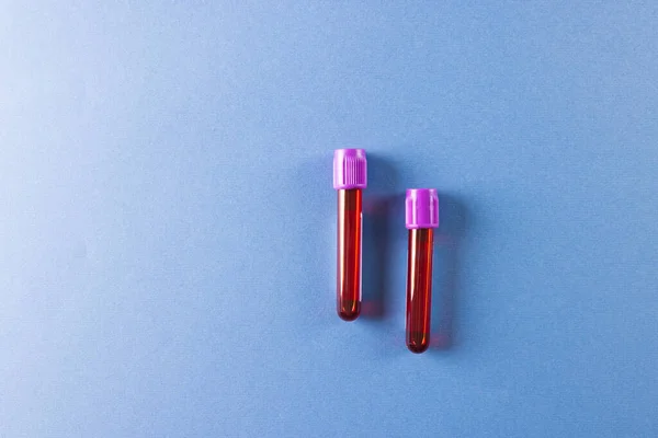 Dos Tubos Muestra Sangre Con Tapas Color Púrpura Sobre Fondo — Foto de Stock