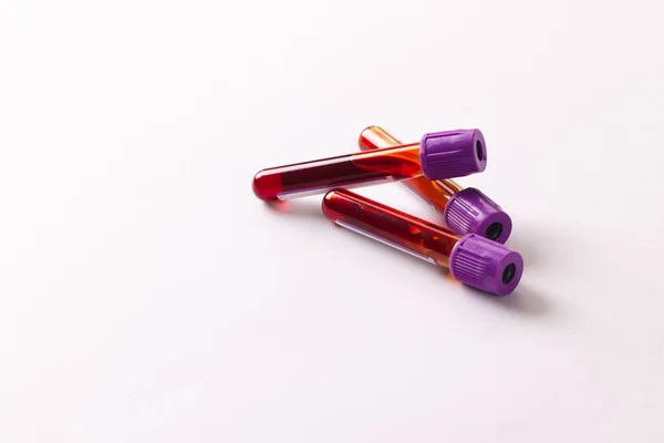 コピースペースの白い背景に紫色の蓋のある3つの血液サンプルチューブ 血液健康診断 — ストック写真