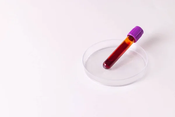 Tubo Amostra Sangue Placa Petri Sobre Fundo Branco Com Espaço — Fotografia de Stock