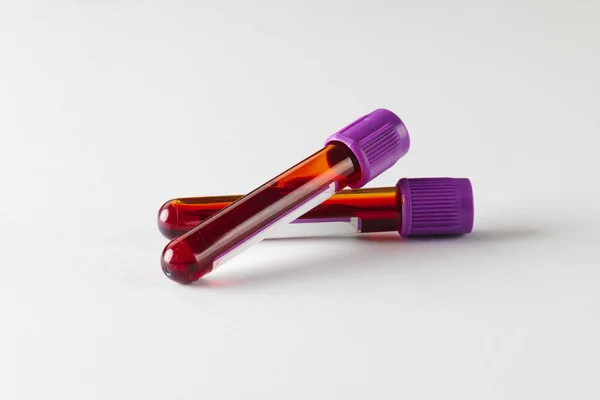 两个有紫色盖子的血样管 白色背景 血液健康诊断 分析和献血 — 图库照片