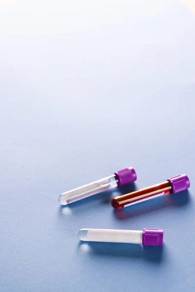 三个有紫色盖子的样品管 一个装有血 蓝色背景 有复制空间 血液健康诊断 分析和献血 — 图库照片