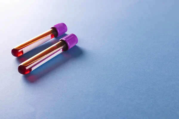 紫色の蓋のある2つの血液サンプルチューブは コピースペースのある青い背景にあります 血液健康診断 — ストック写真