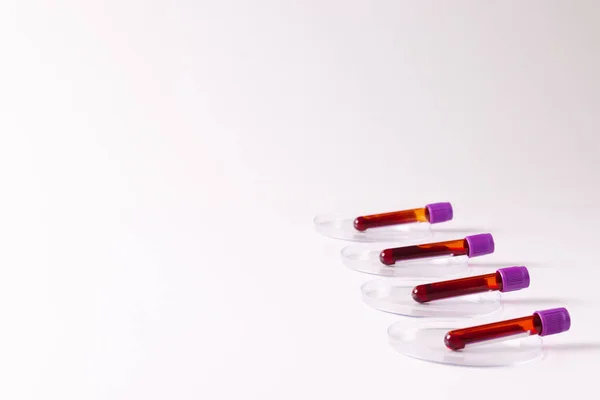 ペトリ皿の血液サンプルチューブの行 コピースペースと白の背景に 血液健康診断 — ストック写真