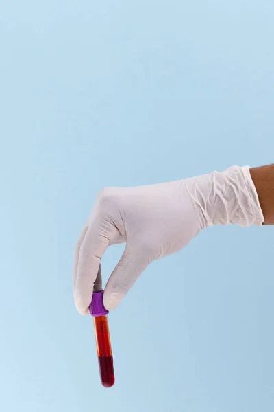 Hand Witte Chirurgische Handschoen Met Bloedmonster Buis Blauwe Achtergrond Met — Stockfoto