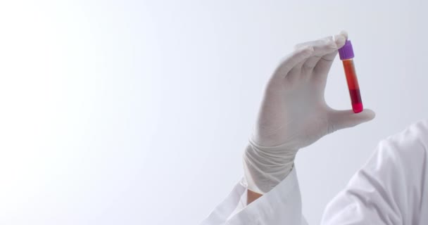 Hand Dragen Van Medische Handschoen Met Bloedmonster Witte Achtergrond Met — Stockvideo