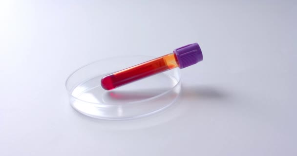 Close Blood Sample Petri Dish White Background Copy Space Slow — Stock Video