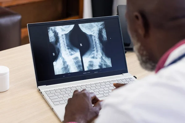 African American Male Doctor Using Laptop Radiograph Screen Doctor Office — Stock Photo, Image