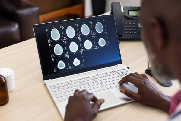 Médico Afro Americano Usando Laptop Com Radiografia Tela Consultório Médico — Fotografia de Stock