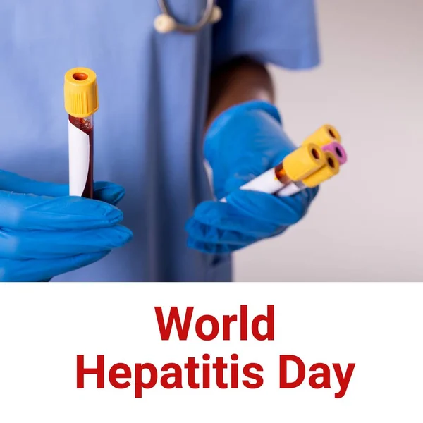Composição Texto Mundial Sobre Hepatite Dia Biracial Médico Segurando Tubos — Fotografia de Stock