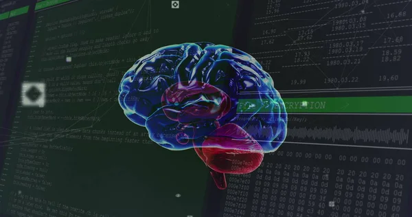 Image of human brain spinning and data processing over computer screens. digital interface, global medicine, technology and connection concept digitally generated image.