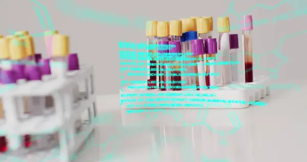 Image of data processing over test tubes. Global medicine and digital interface concept digitally generated image.