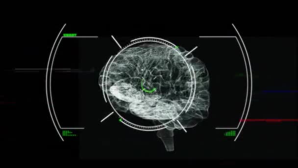 Анімація Обсягу Обробки Даних Над Людським Мозком Глобальні Єднання Обчислення — стокове відео