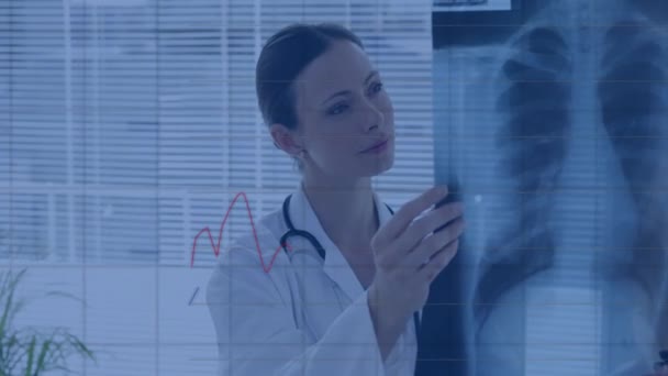 Röntgen Taramalarına Bakan Beyaz Kadın Doktor Üzerinden Finansal Veri Işleme — Stok video