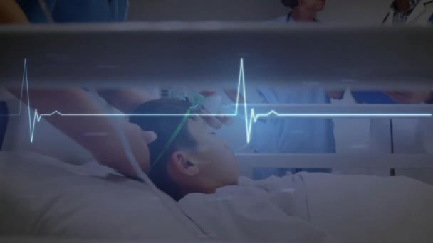 Animation Des Blauen Herzschlagmonitors Über Verschiedenen Ärzten Und Patienten Krankenhaus — Stockvideo