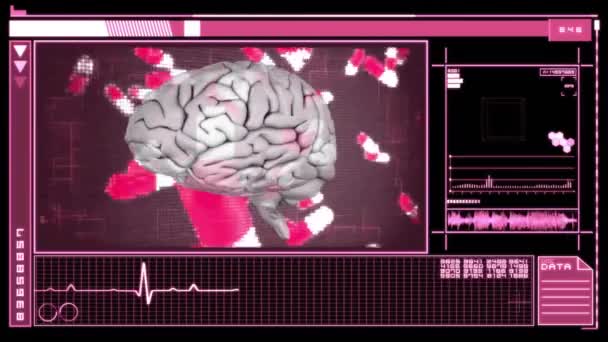 Ekranda Insan Beyni Veri Işleme Animasyonu Küresel Tıp Bağlantılar Hesaplama — Stok video