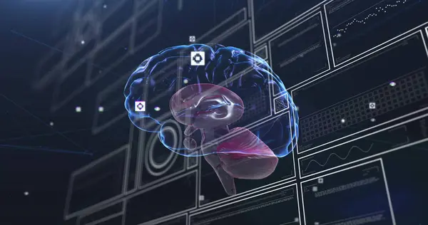 Imagen Del Cerebro Humano Procesamiento Datos Ciencia Global Investigación Conexiones —  Fotos de Stock