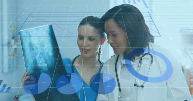 Röntgen raporunu inceleyen kadın doktor ve sağlık çalışanlarına karşı istatistiksel veri işleme. küresel finans ve tıbbi araştırma teknolojisi kavramı