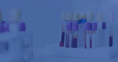 Kan testi konsepti, beyaz askıların 3 boyutlu mercekli örnek tüpleri tuttuğunu gösteriyor. Laboratuvar, sağlık, tanı, tıbbi, araştırma, bilim, klinik