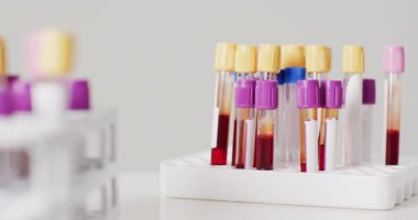 Beyaz arka planda test tüplerinin yakın çekim videosu. küresel tıp ve sağlık konsepti.