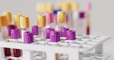 Beyaz arka planda test tüplerinin yakın çekim videosu. küresel tıp ve sağlık konsepti.