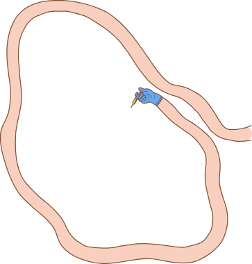 Düz dizayn pembe tüp döngüsünü gösteriyor, mavi eldiven temiz bg üzerinde sarı damlatıcıyı tutuyor, kopyalama alanı. Soyut, minimalizm, biyomedikal, sağlık, bilimsel, illüstrasyon, yenilik
