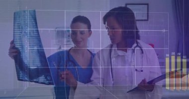 Hemşire röntgen filmi tutuyor ve verileri analiz ederken şebeke dalga boyu çizelgesinde kayboluyor. Tıbbi, sağlık, analiz, teşhis, görselleştirme, profesyonel, dijital